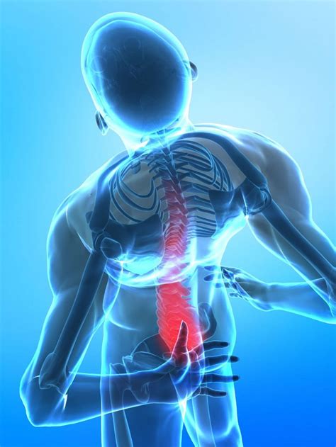 Areas Of Back Pain And What They Mean Wiki Articles