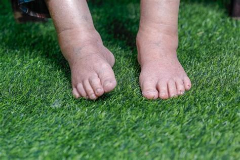 10 Things Your Feet Reveal About Your Healthare Your Feet Cold All The