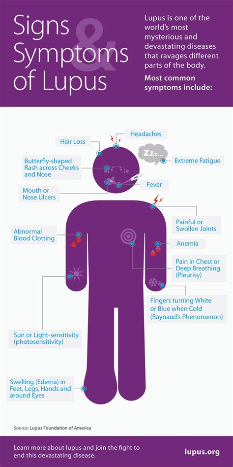 What Might My Symptoms Be Newlifeoutlook Lupus