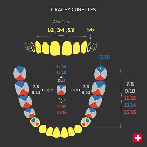 Periodontal Curettes Focus On Gracey Curettes • Dental Hand Instruments
