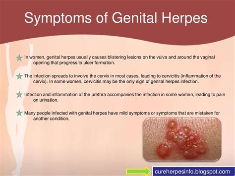 Genital Herpes Symptoms Bing Images