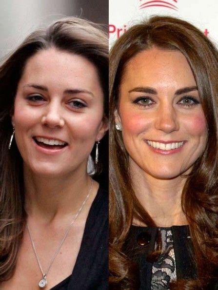Before And After Catherine Duchess Of Cambridge Theres Hope For Us