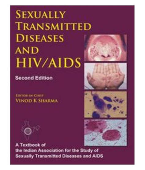 Sexually Transmitted Diseases And Hivaids 2e Buy Sexually