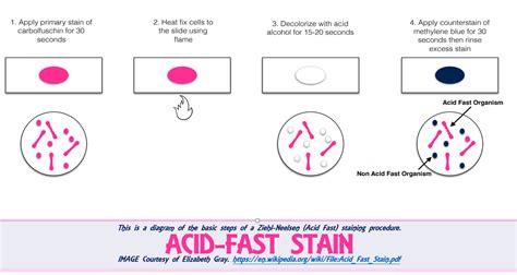 Ex 9 Acid Fast Stain Scientist Cindy