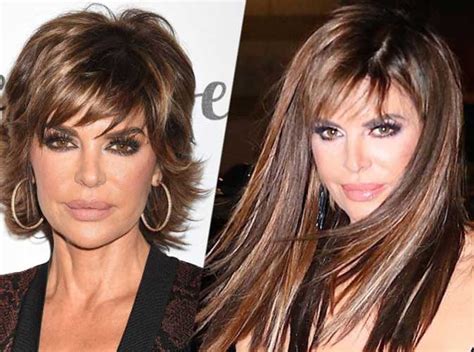 Lisa Rinna Lip Surgery Before And After Photos Hot Sex Picture