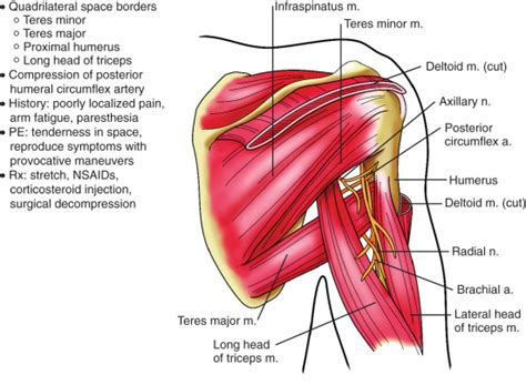 Multidirectional Shoulder Instability Musculoskeletal Key