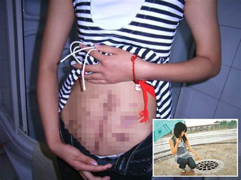 公園の噴水に女性器を突き破られた中国の女子大生（画像） ポッカキット