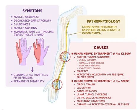 Symptoms Of Cubital Tunnel Syndrome Medizzy