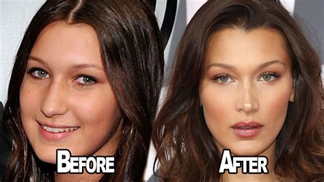 bella hadid opens up about having plastic surgery youtube
