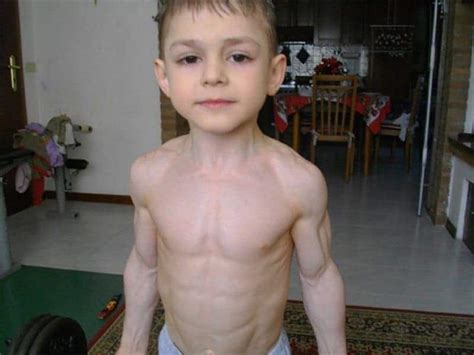 20 Of The Most Shocking Physical Mutations
