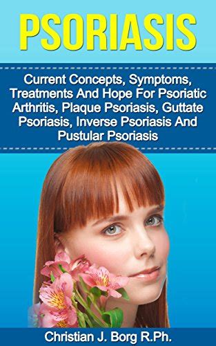 Psoriasis Current Concepts Symptoms Treatments And Hope For