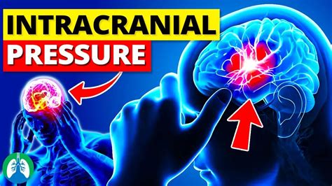 Intracranial Pressure Icp Quick Explainer Video 🧠