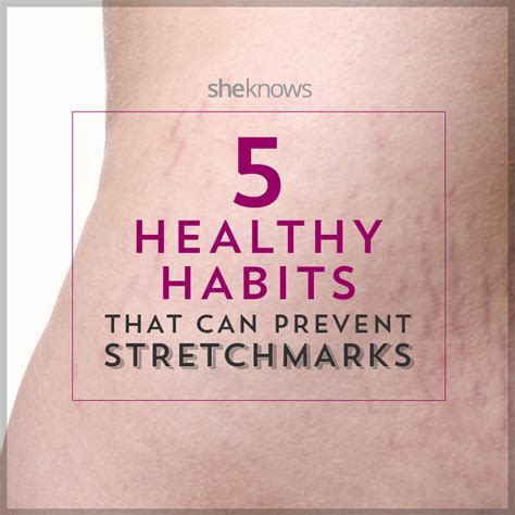 5 Ways To Battle Stretch Marks During Pregnancy Before They Start Sheknows