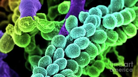 Streptococcus Bacteria Colored Scanning Electron Micrograph