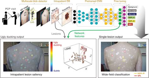 Using Deep Learning For Dermatologist Level Detection Of Suspicious