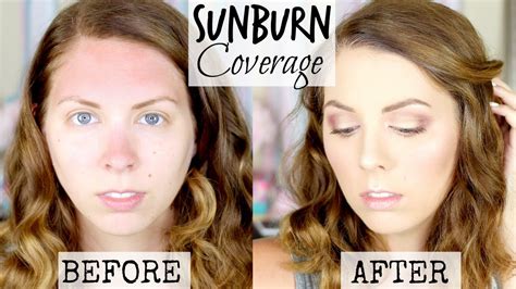 How To Cover Sunburn Rosacea With Makeup Tutorial By Colormecassie