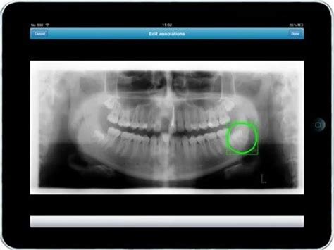 Esg Divisi N M Dica Imaging Ipad App Dental App Ipad Ipad Dental