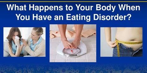 what are the 7 examples of disordered eating patterns