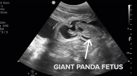 Baby Panda Seen ‘kicking And Swimming On Mei Xiangs Ultrasound