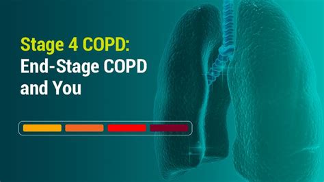 What To Know About The Four Stages Of Copd Images