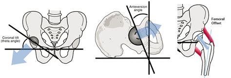 Tha Stability Techniques Recon Orthobullets