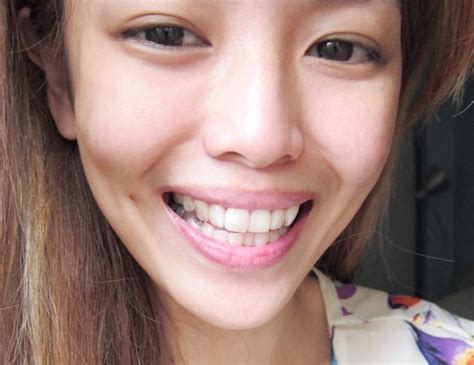 Once you've completed your orthodontic treatment, how long should you wear a retainer? Invisalign: A Complete Guide from the Top-Rated ...