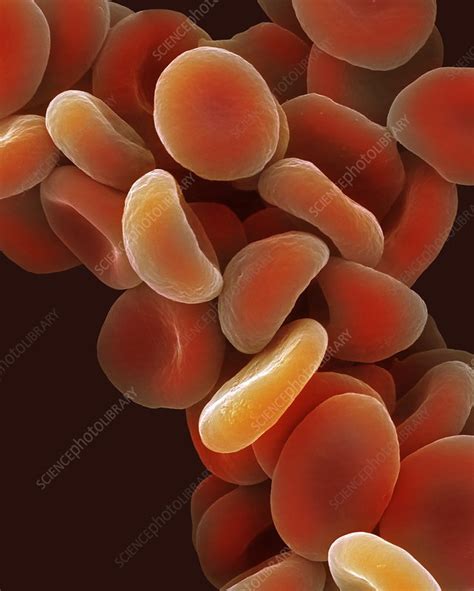 Human Red Blood Cells Sem Stock Image C0460623 Science Photo