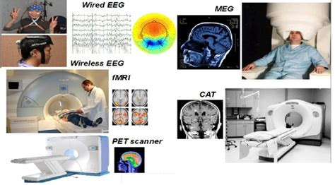 Examples Of Modern Imaging Devices Both Invasive Active Imaging