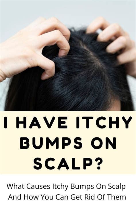 What Causes Itchy Bumps On Scalp And How You Can Get Rid Of Them Home Hot Sex Picture