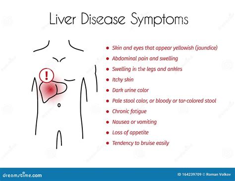Vector Liver Disease Symptoms Infographic Of Young Man Stock Vector