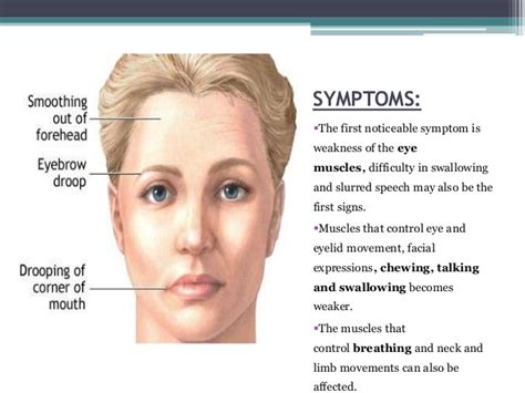 Myasthenia gravis occurs in all ethnic groups and both females and males. Elder Law and Myasthenia Gravis | Blog