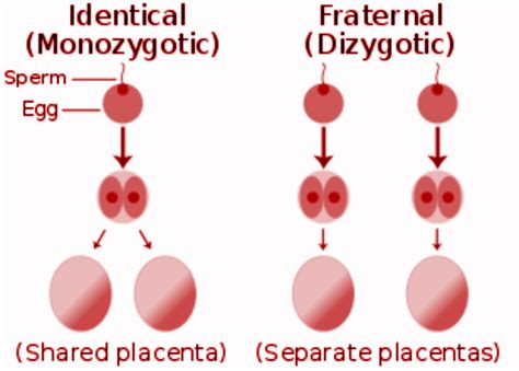 differentiate between monozygotic twins and dizygotic twins