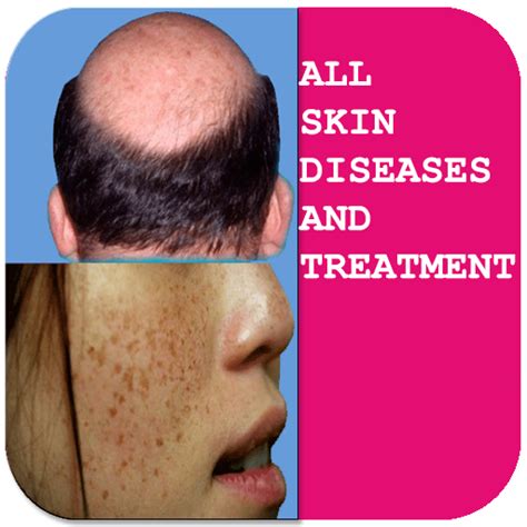 App Insights Skin Diseases And Treatment Of Apptopia