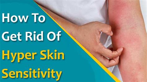 How To Get Rid Of Hyper Skin Sensitivity