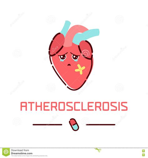 Atherosclerosis Heart Disease Stock Illustration