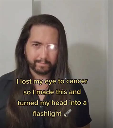 Man Turns His Right Eye Into A Flashlight After Losing It To Cancer