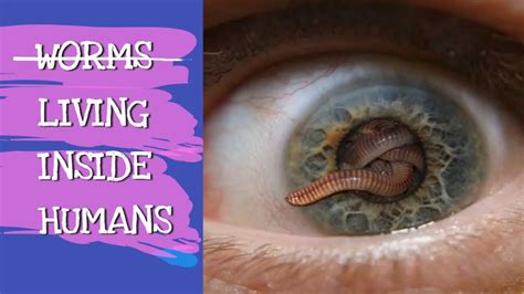 Worms Living Inside Humans Explained Youtube