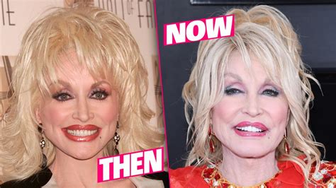 Dolly Parton Surgery