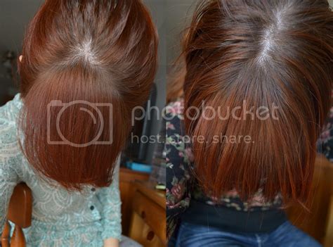 Brewer's yeast is a rich source of biotin, which is essential for hair growth, according to the university of maryland 1. 14 days of biotin + brewer's yeast (photos)