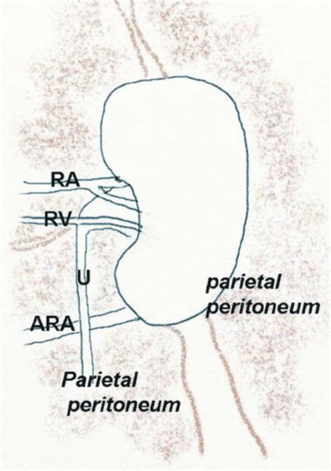 Schematic View Of The Normal Position Of The Kidney Retroperitoneal