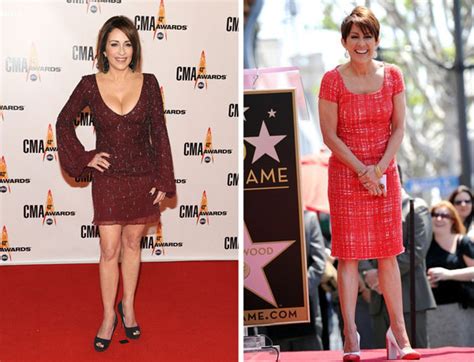 Patricia Heaton Plastic Surgery Before And After Pictures