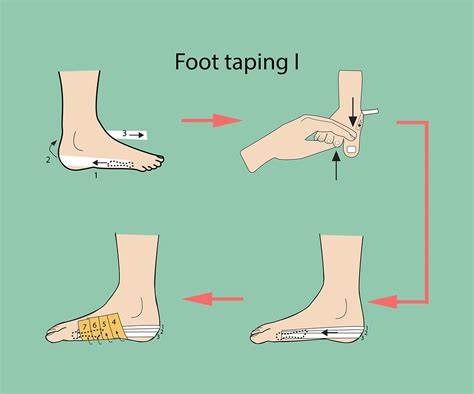 4 Ways Of Taping Your Foot Plantar Fasciitis Or Foot Arch Support