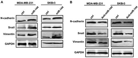 microrna 144 affects radiotherapy sensitivity by promoting proliferation migration and invasion