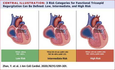 Natural History Of Functional Tricuspid Regurgitation Quantified By