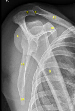 Shoulder Lateral Scapula View Radiology Reference Article