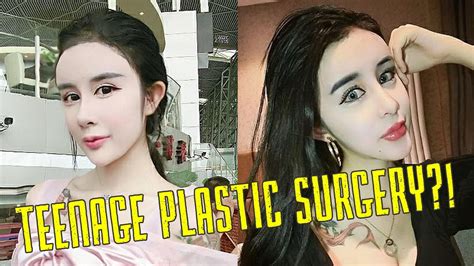 15 Year Old Gets Extreme Plastic Surgery Cosmetic Surgery In Asia Youtube