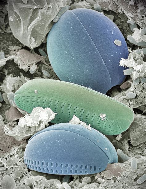 Diatom Algae Sem Photograph By Steve Gschmeissner Fine Art America