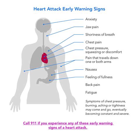 Know The Signs Of A Heart Attack Saint Francis Healthcare System