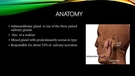 Submandibular Gland Excision
