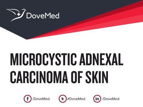 Microcystic Adnexal Carcinoma Of Skin Dovemed